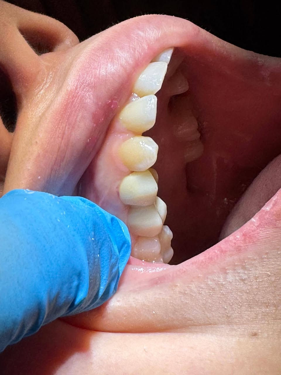 مثلما عودناكم … جمال شغلنا 😎
       والترتيب الصح  يمنا وبس 😇💪🏻

                👈🏻 👨🏻‍⚕️  تركيب اسنان زاركون  بطبعه الحديثه الألكترونيه 😇💪🏻

           🌸 أمهر اطباء الأسنان 🌸
                👨🏼‍⚕️👨🏻‍⚕️👨🏽‍⚕️👨🏼‍⚕️
 
🌿 العنوان / الحريه داخل سوق الدولعي  🥰
😇 م

    ✨ متواجدين وياكم طيله أيام الأسبوع 
من ساعه 3 والنصف  الئ ساعه 8 والنصف  مۡسَـ(🍀)ـاءآ 

🫶🏻 للاستفسار مراسله الصفحه 
🌷 او الاتصال بالرقم  ***********
@إشارة
