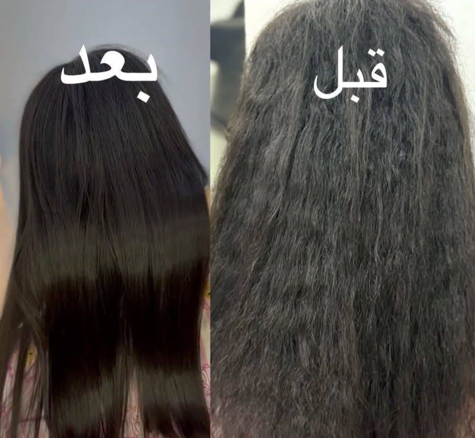 فلر قديم • متكتل • قبل وبعد