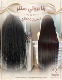 رنا بيوتي • حي الخضراء • ليزر