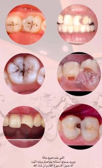 علاج مجاني • كلية طب اسنان • مطار بغداد