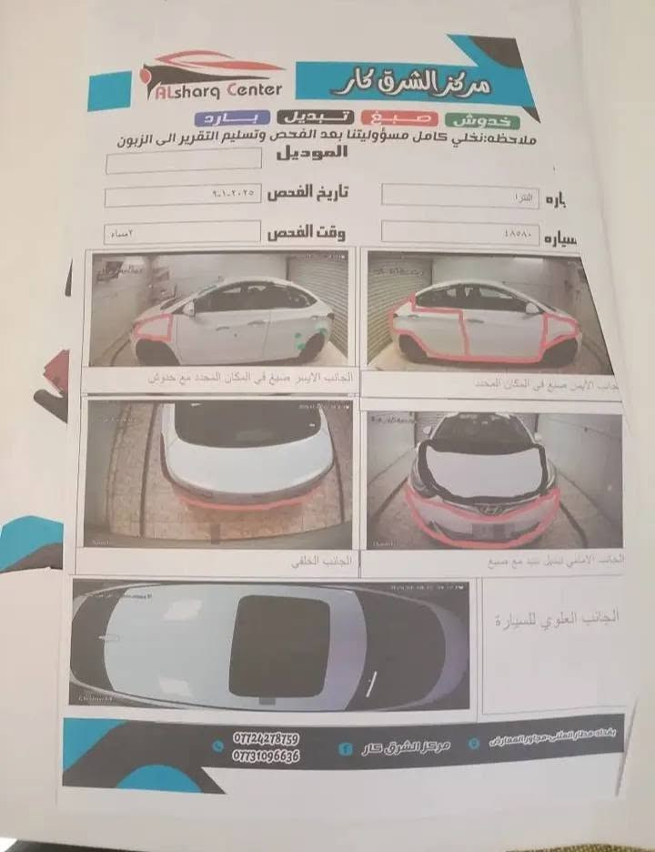 للبيع النترا 2015 فول عدة البصمة
مكينة كير صدر تبريد ثلج دواخل جدد فتحة شاشه جبيرة تحكمات ستيرن تدفئة بلكشنات تخم تايرات وبعد بيهه مواصفات السيارة استخدام شخصي فقط بيهه رشات صبغ موضحه بلسونار
السعر 100 مجالهه بسيط
مكاني بغداد الكرخ ***********
