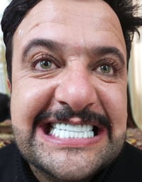 مختبر أسنان • تعويضات سنية • خدمة منزلية