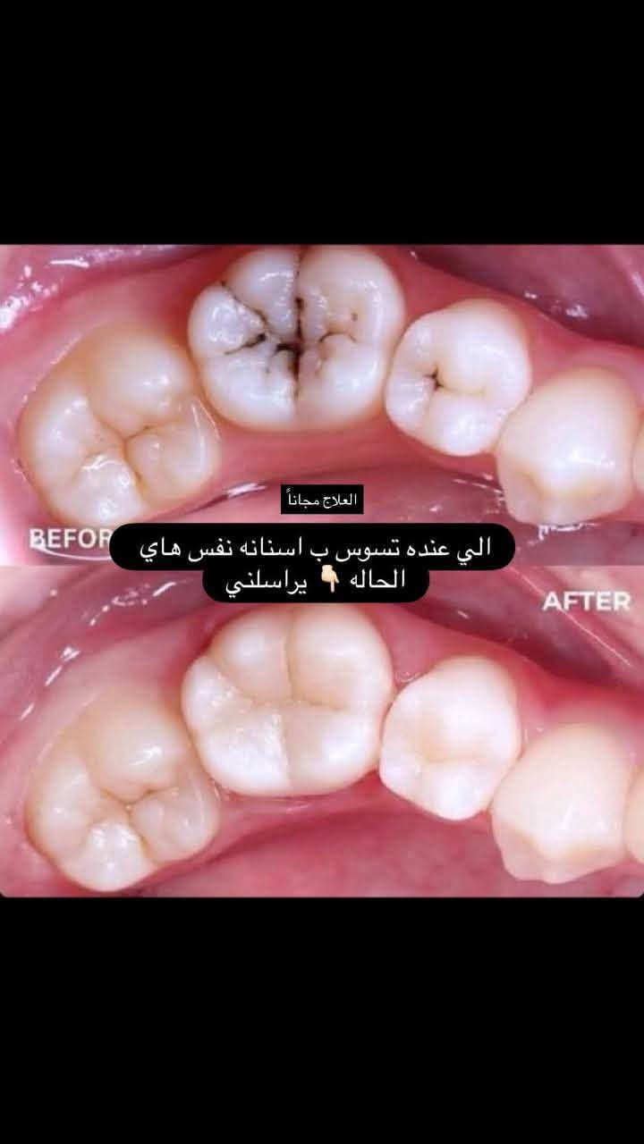 علاج مجاناً • عيادة أسنان • جامعة الزهراوي