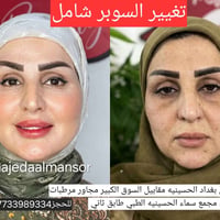 ماجدة المنصور • تجميل وليزر • الحسينيه