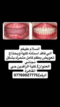 طقم اسنان • متحرك • مجاني