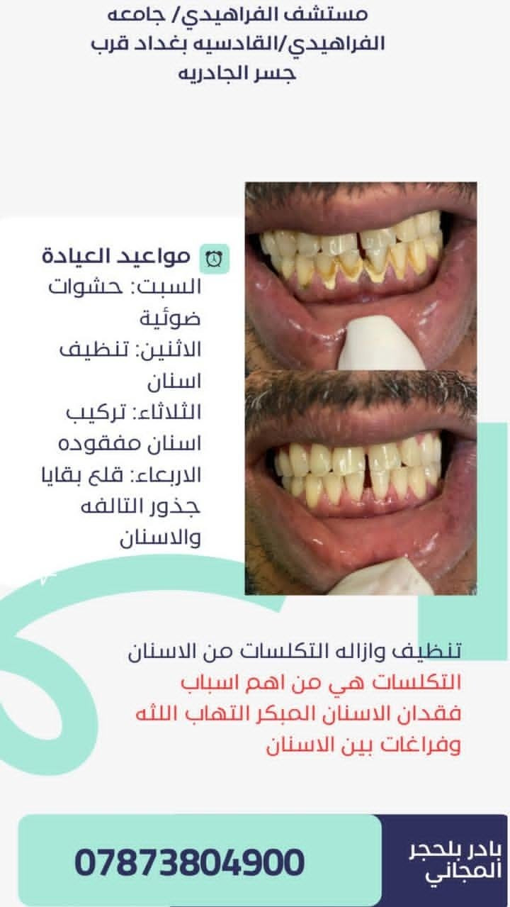 للاستفسار واتساب ***********

نص مكتوب في الصور:
- مستشفى الفراهيدي/ جامعه الفراهيدي/القادسيه بغداد قرب جسر الجادريه dr- Hajer لعلاج كافه مشاكل الاسنان بفحص وعلاج مجاني تحت اشراف نخبه من افضل الاطباء مواعيد العيادة السبت: حشوات ضوئية الاثنين: تنظيف اسنان الثلاثاء: تركيب اسنان مفقوده الاربعاء: قلع بقايا جذور التالفه والاسنان *********** بادر بالحجز المجاني
- مستشف الفراهيدي/ جامعه الفراهيدي/القادسيه بغداد قرب جسر الجادريه مواعيد العيادة السبت: حشوات ضوئية الاثنين: تنظيف اسنان الثلاثاء: تركيب اسنان مفقوده الاربعاء: قلع بقايا جذور التالفه والاسنان تعويض الاسنان المفقوده مجاناً *********** بادر بلحجر المجاني
- مستشفى الفراهيدي/ جامعه الفراهيدي/القادسيه بغداد قرب جسر الجادريه مواعيد العيادة السبت: حشوات ضوئية الاثنين: تنظيف اسنان الثلاثاء: تركيب اسنان مفقوده الاربعاء: قلع بقايا جذور التالفه والاسنان ازاله مختلف انواع التسوسات وبناء حشوات ضوئيه بادر بلحجر المجاني ***********
- مستشفى الفراهيدي/ جامعه الفراهيدي/القادسيه بغداد قرب جسر الجادريه مواعيد العيادة السبت: حشوات ضوئية الاثنين: تنظيف اسنان الثلاثاء: تركيب اسنان مفقوده الاربعاء: قلع بقايا جذور التالفه والاسنان تنظيف وازاله التكلسات من الاسنان التكلسات هي من اهم اسباب فقدان الاسنان المبكر التهاب اللثه وفراغات بين الاسنان بادر بلحجر المجاني ***********