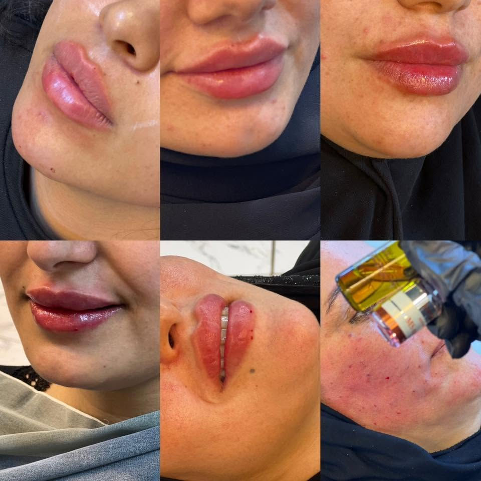 يعلن سنتر
نجمة عن عروضه
***********

نص مكتوب في الصور:
- عروض ال 25 الف في سنتر نجمة -معالج شعر + تنظيف قدم -تنظيف بشرة + رموش كاملة -معالج شعر + تنظيف قدم - صبغ توحيد قاعدة + حفافه -ميش كب كامل + حفافه - تاتو + حفافه -تاتو وشم + حفافه - تاتو توريد شفه + حفافه -تنظيف قدم + تنظيف وجه -توحيد لون + قص شعر + شسوار قص شعر مدرج +تنظيف بشره -منيكير +تنظيف قدم -جلش + دزاين + تنظيف تشرة -اكرلك + شمع وجه -مكياج مدعوات + رموش + شسوار -حقن نضاره +تنظيف بشره للحجز ***********