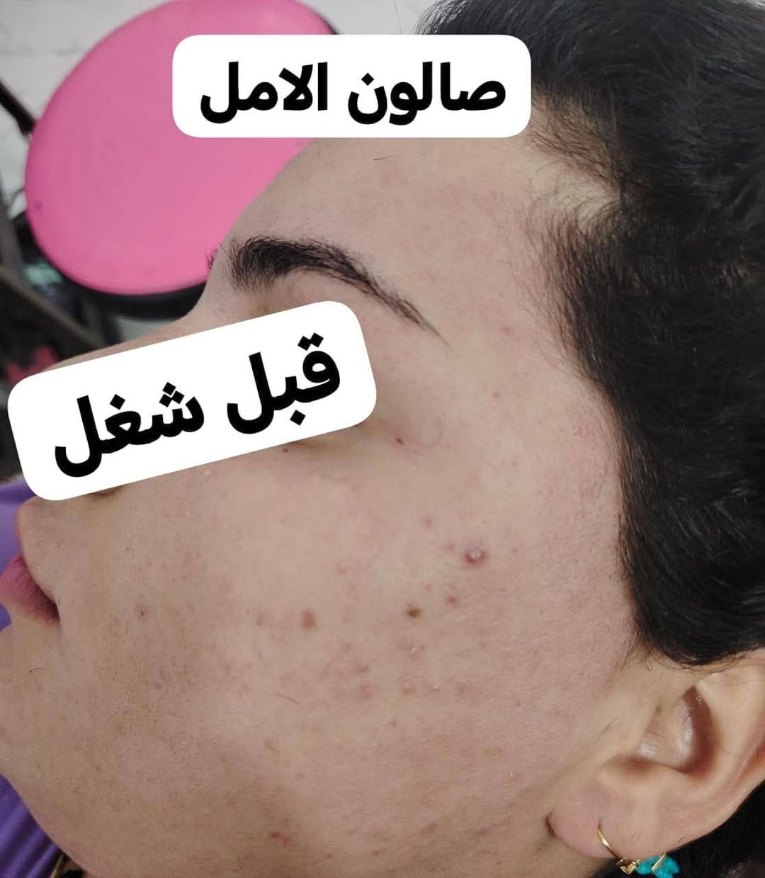 صالون الأمل • تنضيف عميق • الكوت حي الجهاد