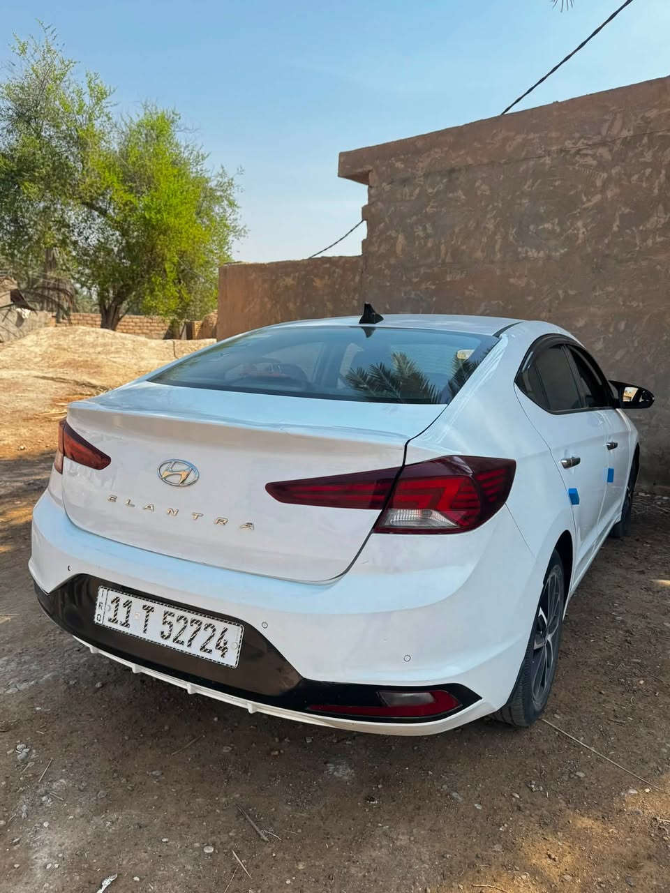 السلام عليكم النترا مديل 2019  خليجي ماشيه 100 الف مكفوله بس الي موضح بل صوره البنيد مفتوح بدون صبغ مثل مامئشر رصعات السياره محرك 2000 دوش ايتي السيارة جديده كامله من كلشي مكان السياره الخالص 145 السيارة بسمي 
***********
