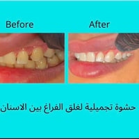 ابتسامة • عيادة اسنان • المحمودية