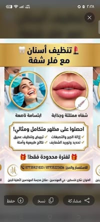 تنظيف أسنان • فلر شفايف • حي المهندسين