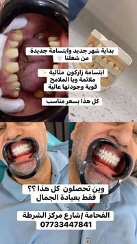 ابتسامة زاركون • ضمان ١٠ سنوات • عيادة الفحامة