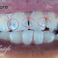 علاج اسنان مجاني • حشوات وتنظيف • جامعة ذي قار