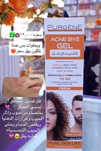 الحل النهائي لحبوب الوجه، الآثار، والدهون المزعجة وصل للصيدلية! إذا تع...