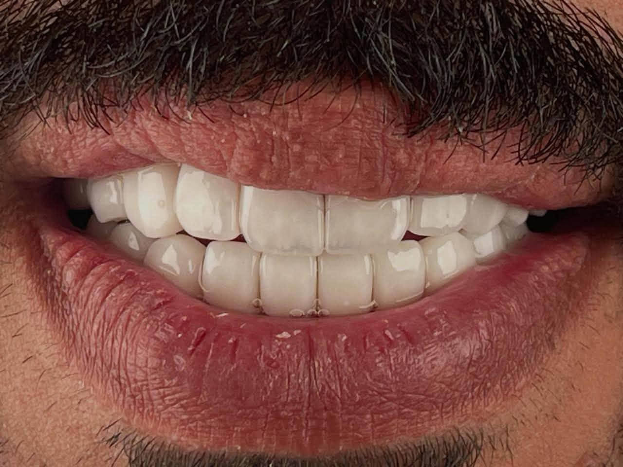 لأن ابتسامتك هي أول ما يلاحظه الآخرون، ومنها تبدأ ثقتك بنفسك 😍

متواجدين طيلة ايام الاسبوع
  نستقبلكم بكل حُب♥️
العنوان : الديوانية/ تحت الجسر المعلق / بناية فندق الديوانية سابقًا / مقابل المحافظة

للحجز والاستفسار 
***********
***********⁩

