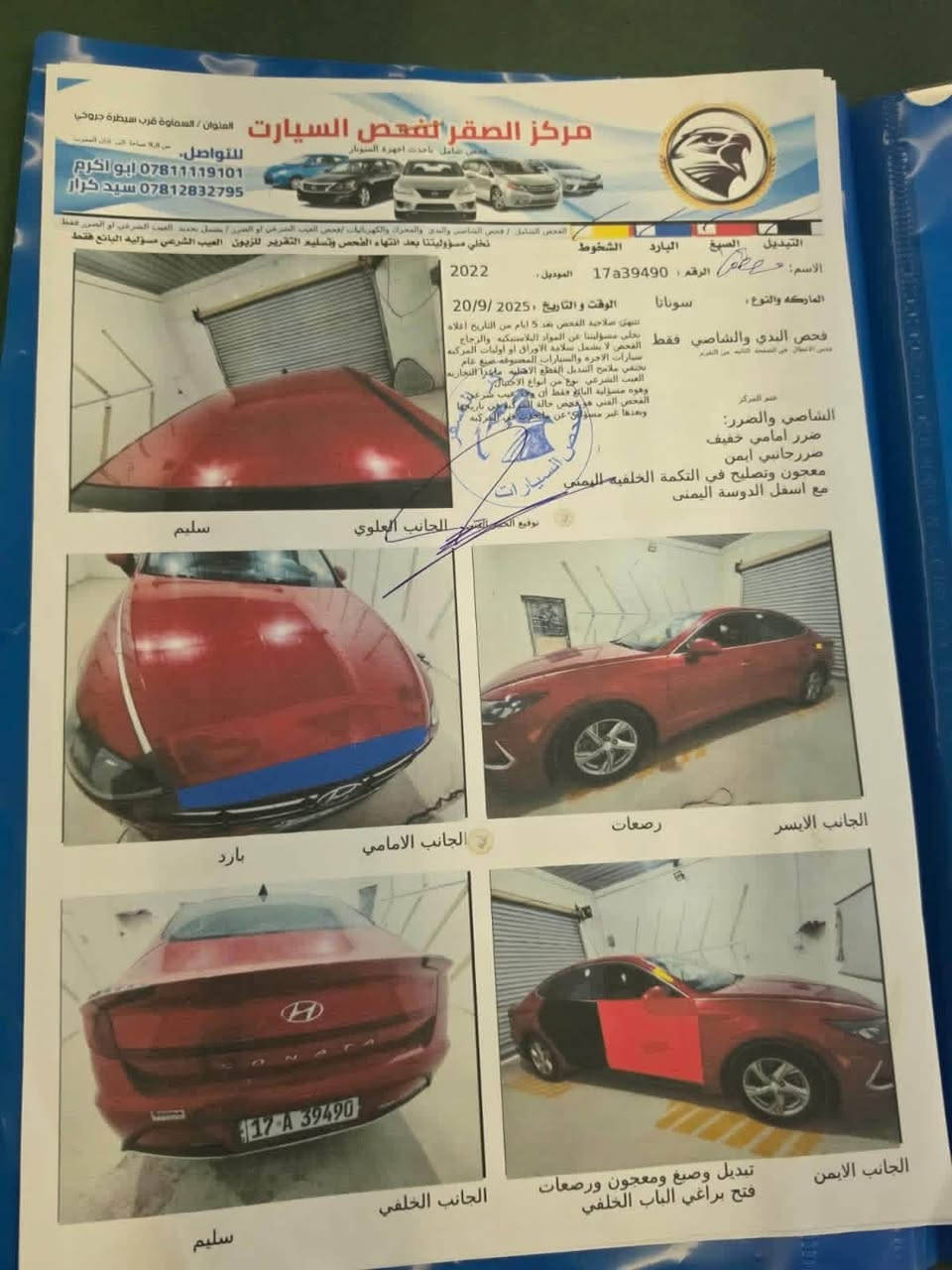 السلام عليكم
سوناتا موديل 22 وارد امريكي
سياره خير من الله
حداديه جديده
تخم تاير
كامره اماميه وخلفيه
كذالك رادار وتحكم في السرعه 
سياره معوقين انطيك وكاله عامه
مكان سياره الرميثه
السعر 155 وبيهه مجال
سونار السياره بالصور
فقط تبديل باب ولباب ثاني فقط رش صبغ
رقم الهاتف ***********
