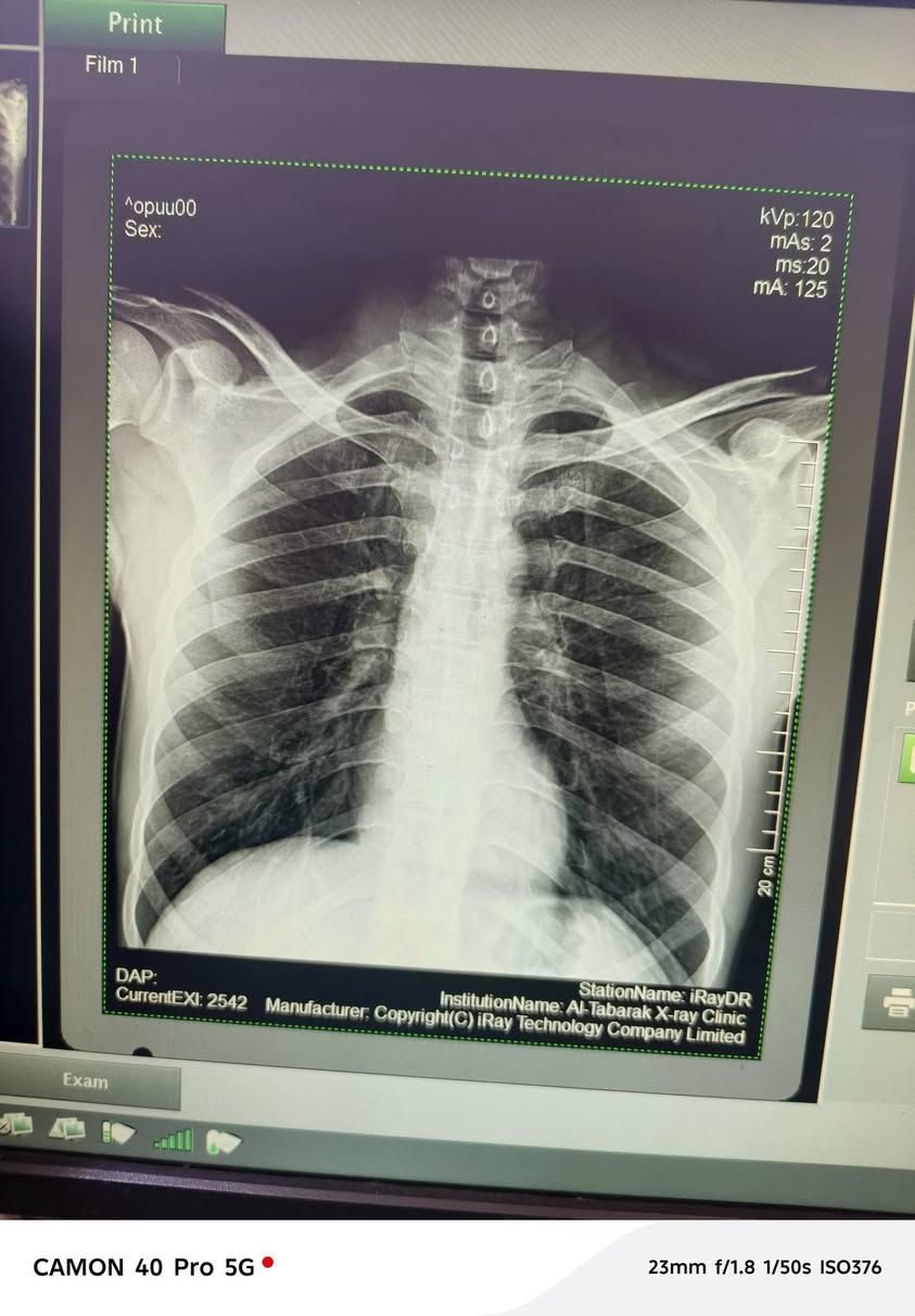 عياده التبارك 
للاشعه العاديه والملونه🩻👨🏻‍⚕️
الموقع الشرقاط
شارع الاطباء مجمع الماس الطبي بين عياده الدكتور عبد الرزاق الترف ولدكتور زين العابدين
📍رقم الهاتف ***********
