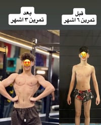 #قبل #بعد  هذا الاعب بي سكر  وتهشم بالعظم فضل الله والحمد الله تم التغ...