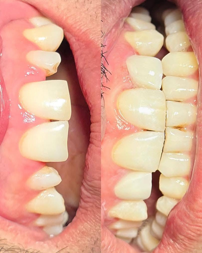 مجمع اهلنا النموذجي الطبي 
عيادة أونو 
لطب تجميل الأسنان 
بتواجد 
الدكتور محمد رحم الحجامي 
والدكتور احمد الصافي 
العنوان خلف سيد جعفر 
نهاية شارع الصناعي 
الديوانية قضاء البدير 
للحجز والاستفسار 
***********
