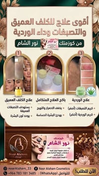 نور الشام • كلف عميق • داء الوردية