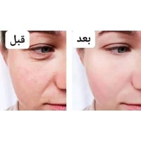 ‏ La roche - posay  ‏🌟 Retinol B3 Serum 🌟 ▪️سيروم ريتينول من شركة لارو...