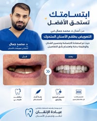 ابتسامتك تستحق الأفضل ✨ من أعمال د. محمد جمال في تعويض الأسنان باستخدا...