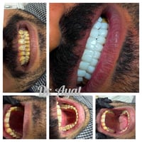 عيادة الآيات • طب الاسنان • تجميل