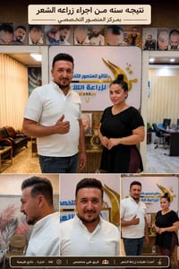 نتيجة لأحد زبائن مركز المنصور🤍✔️  #المركز الاول بالعراق لزراعه الشعر ب...