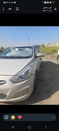 اكسنت ٢٠١٧ • بدون صبغ • كفاله