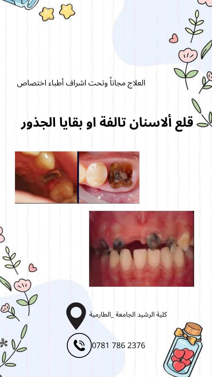 علاج أسنان مجاني • حشوات تجميلية • كلية الرشيد