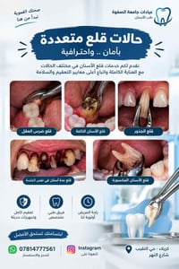 قلع جذور مجاني • عيادات الصفوة • كربلاء حي النقيب