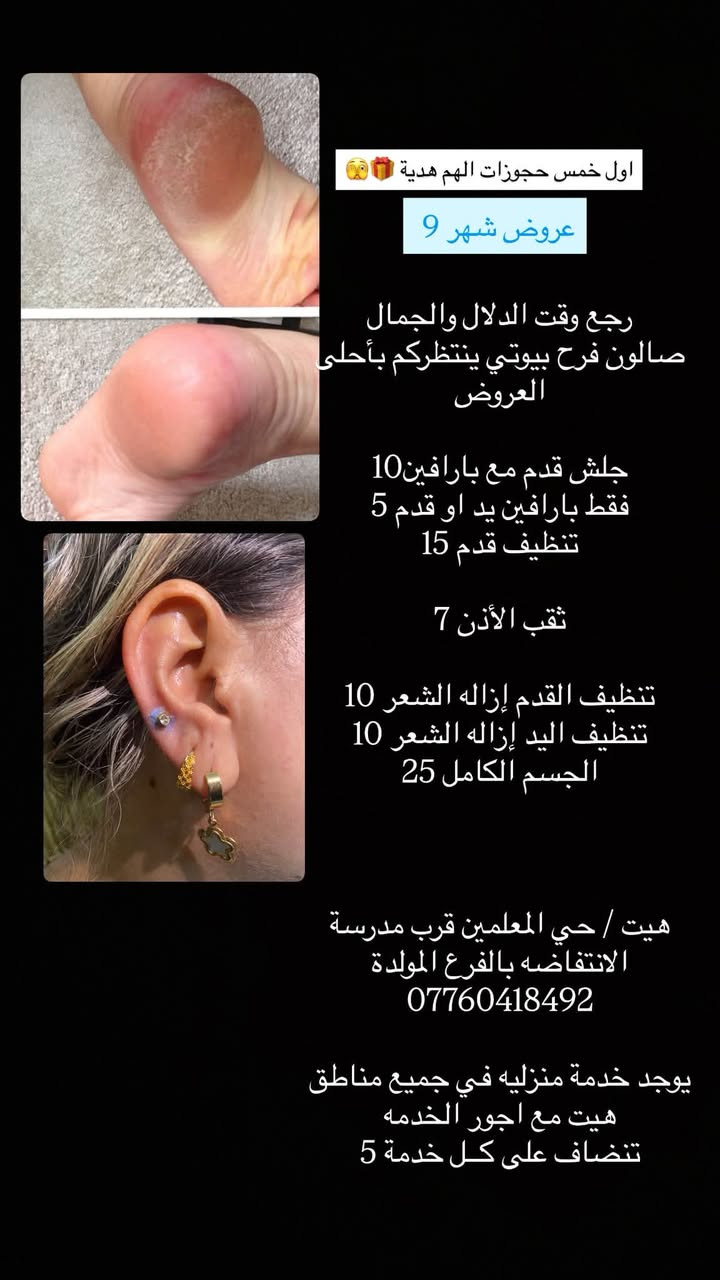 احلى العرووووض من صالون فرح بيوتي 🩷 🎀 
اوووول خمس حجوزااات الهن هدييية 🌚🎁🛍️
العنوان ، هيت حي المعلمين قرب مدرسة الانتفاضه 
متوفرة خدمة منزلية جميع مناطق هيت 🫶🏻
للحجز على الرقم او واتس ✨
*********** 
تنوروني واستقبلكم بكُل حُب 🫂🩷
