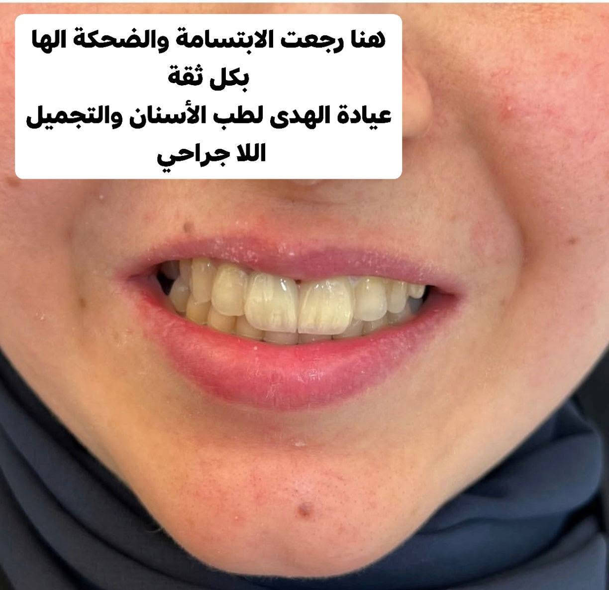 عيادة الهدى • أسنان وتجميل • تقاطع الجدوع