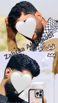خلال شهر • توقف تساقط • نمو سريع