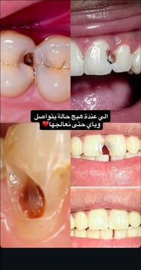 علاج اسنان • مجاني • اطباء مختصين