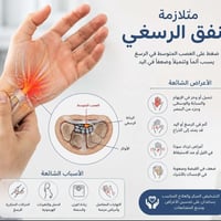 متلازمة العصب الرسغي • علاج طبيعي • بغداد العامرية