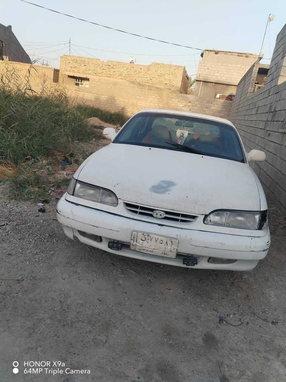 سوناته موديل 94 حائز ثالث سياره جاهزه اي نقص مابيه السعر ١٨ وبيه مجال قليل السياره جاهزه مراوس حسب القناعه
***********

نص مكتوب في الصور:
- O HONOR X9a
- 64MP Triple Camera
- HONOR X9a