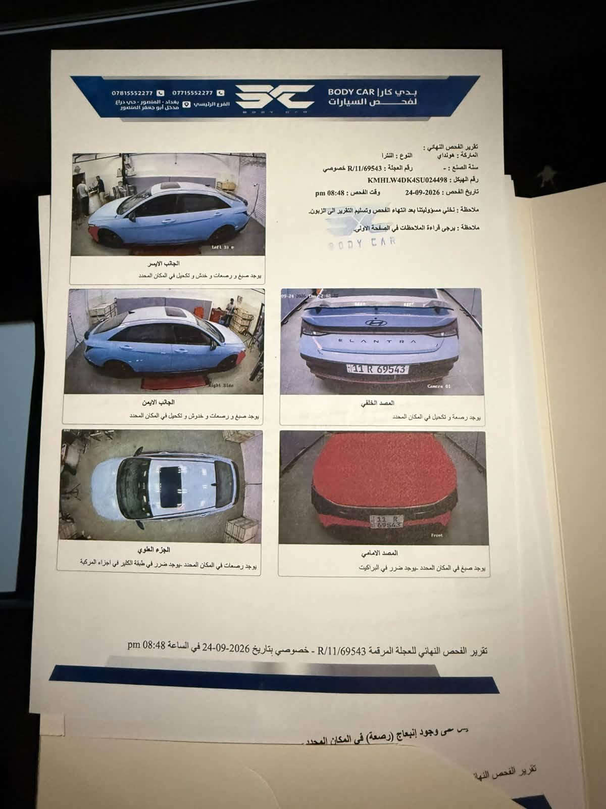 السلام عليكم اخواني
اذا عجبتك السيارة ف تدلل عليه واذا معجبتك نورني بكلمة طيبة بالمنشور🌹

النترا N لون سمائي مميز موديل 2025 ماشية 15 الف كيلومتر السيارة جديدة بمعنى الكلمة بيها البنيد مطعج ومتصلح نفسه بدون ما ينفتح وبيه اماكن بسيطه صبغ على كد التصليح بس السونار يقره صبغ قطعه كامله وعندي فديو للتصليح وبيها ايرباك الستيرن طاك وراجع سستم سيارة كلشي بيها بلادي ومامبدل
بيها اي شي ومكفولة من كلشي كير مكينة شاصي لغود كله مكفول سيت تايرات جديدة ومبدله دهن قبل اسبوعين سيارة ستوك ما مزودة وصوتها البلادي يخبل وكاصها على ايدي على كد الدوام تجي تشوفها وتسوقها وتقتنع بيها واني حاضر رقم بغداد باسمي تحويل ثاني يوم وهزتها جديدة وجاهزة على اخر حبه ومابيها غرامات
السعر على الخاص وباقي التفاصيل🌹
متواجد هنا او اتصال او واتس 
***********
