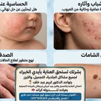 توته كراند  نص مكتوب في الصور: - الحساسية عند الأطفال هل تبحثين عن حل ...