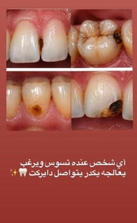 كربلاء السعديه • خدمات مجانية • حشوات ضوئية