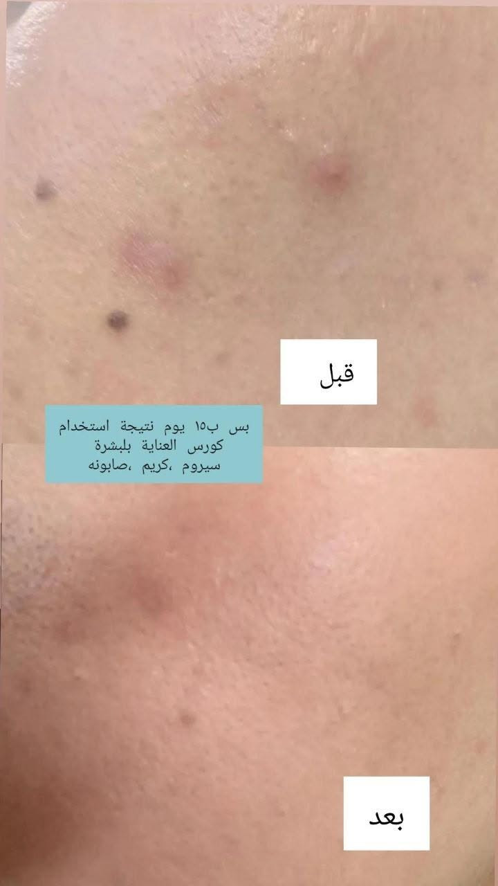 صيدلانية • كورس بشرة • علاج تساقط الشعر