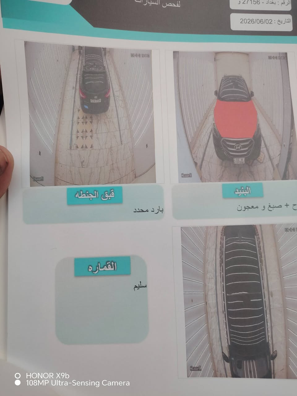 توكسن ١٤ امريكي فول اعلى فئة بصمة بانوراما كشنات جلد كهربائية تدفئة كشنات تبريد قطعتين فور ويل مانع انزلاق كاميرا وحساسات لدات امامي وخلفي وبعد بيها هواي مواصفات حادث بسيط بدون ايرباك وبدون دواخل صور الحادث والسونار مرفقة مع المنشور السعر ١١٥ بيع او مراوس
توكسن ١٤ امريكي فول اعلى فئة بصمة بانوراما كشنات جلد كهربائية تدفئة كشنات تبريد قطعتين فور ويل مانع انزلاق كاميرا وحساسات لدات امامي وخلفي وبعد بيها هواي مواصفات حادث بسيط بدون ايرباك وبدون دواخل صور الحادث والسونار مرفقة مع المنشور السعر ١١٥ بيع او مراوس
***********
