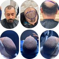 مانحتك ضعيفة؟  وگالولك مستحيل تنزرع بجلسة وحدة؟  لا تستعجل وتدفع كلفة ...