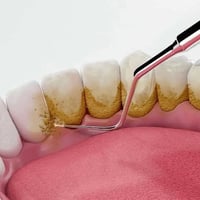 اللي محتاج تنظيف اسنان (علاج مجاني) موجودة العيادة يوم الاثنين صباحا  ...