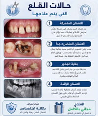 مجاناً • طالبة طب أسنان • عيادات جامعة الموصل