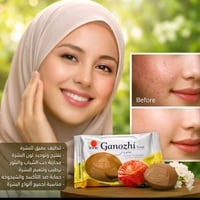 صابونه جانوزي العلاجيه للبشره وللكلف وحب الشباب طبيعيه صحيه تتوفر توصي...