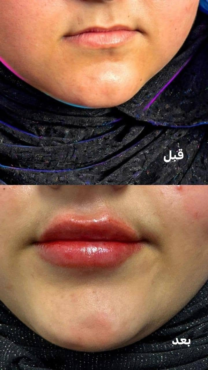 البياع • قبل وبعد • حجز