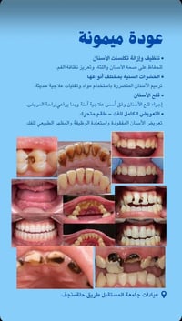 علاج مجاني • تنظيف أسنان • عيادات جامعة المستقبل