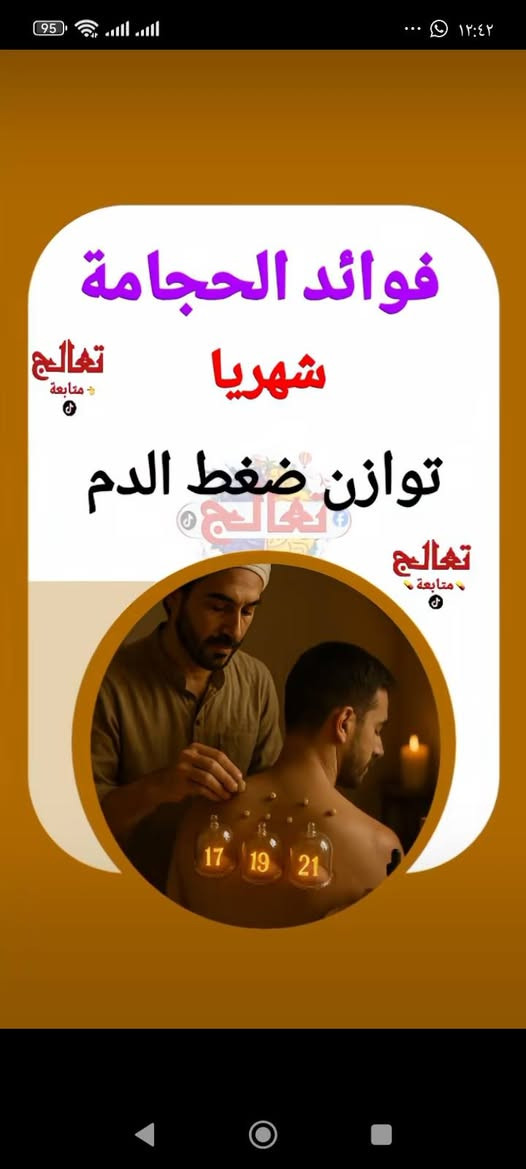 حجامة شهرية • تحسين النوم • تخفيف صداع