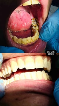 دكتوره غدير الموسوي • قبل وبعد • تجميل